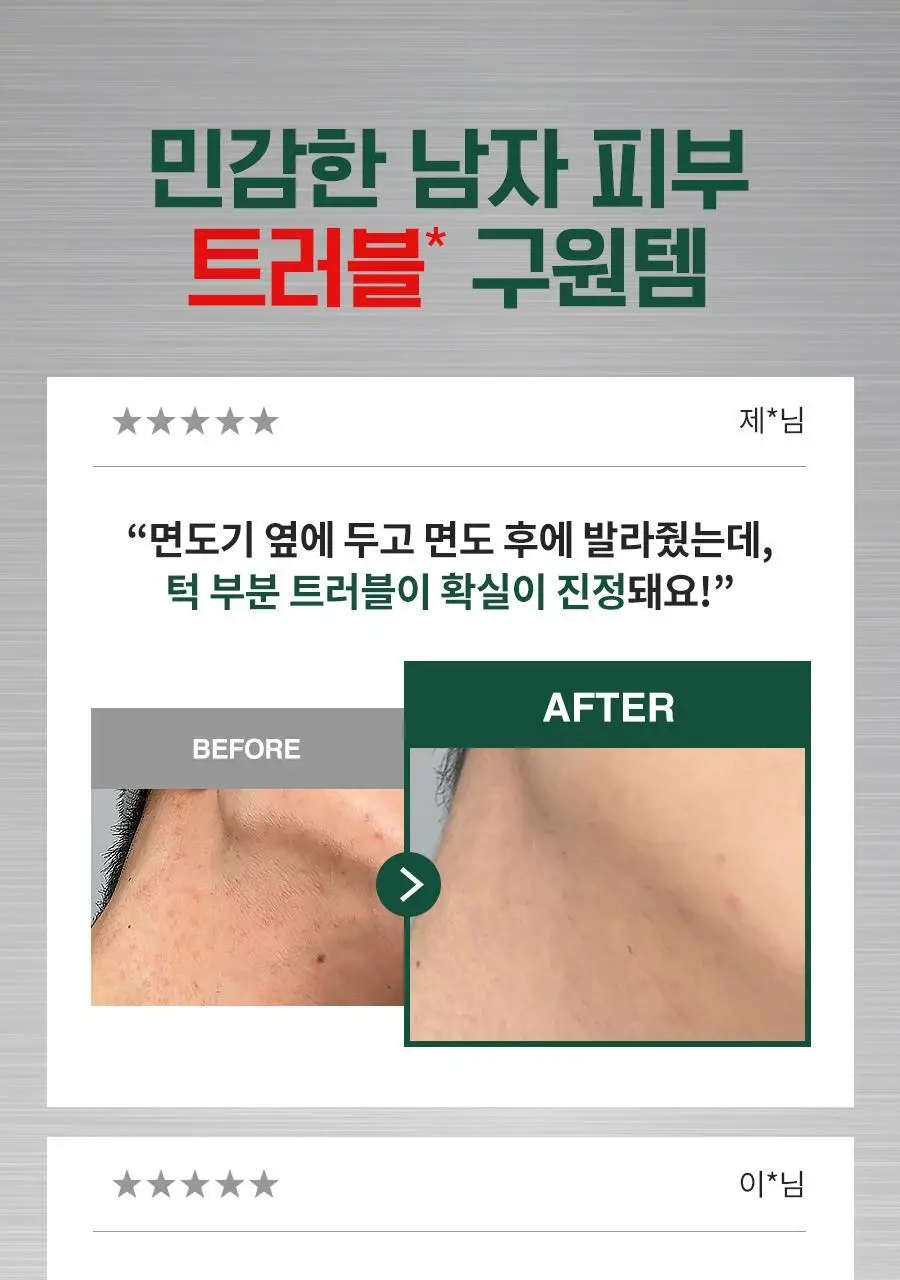 [리뉴얼/트러블/면도후] 닥터지 레드 블레미쉬 포 맨 진정 올인원 150ml 2종 (단품/증정 기획) 상세페이지 5